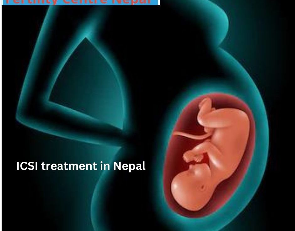 How does a fertility expert perform ICSI in Nepal?